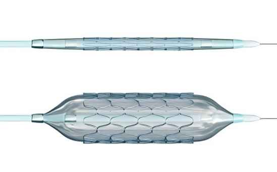 What is the Difference between a Stent and a Balloon Catheter?