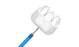 Knowledge about Left Atrial Appendage Occlusion