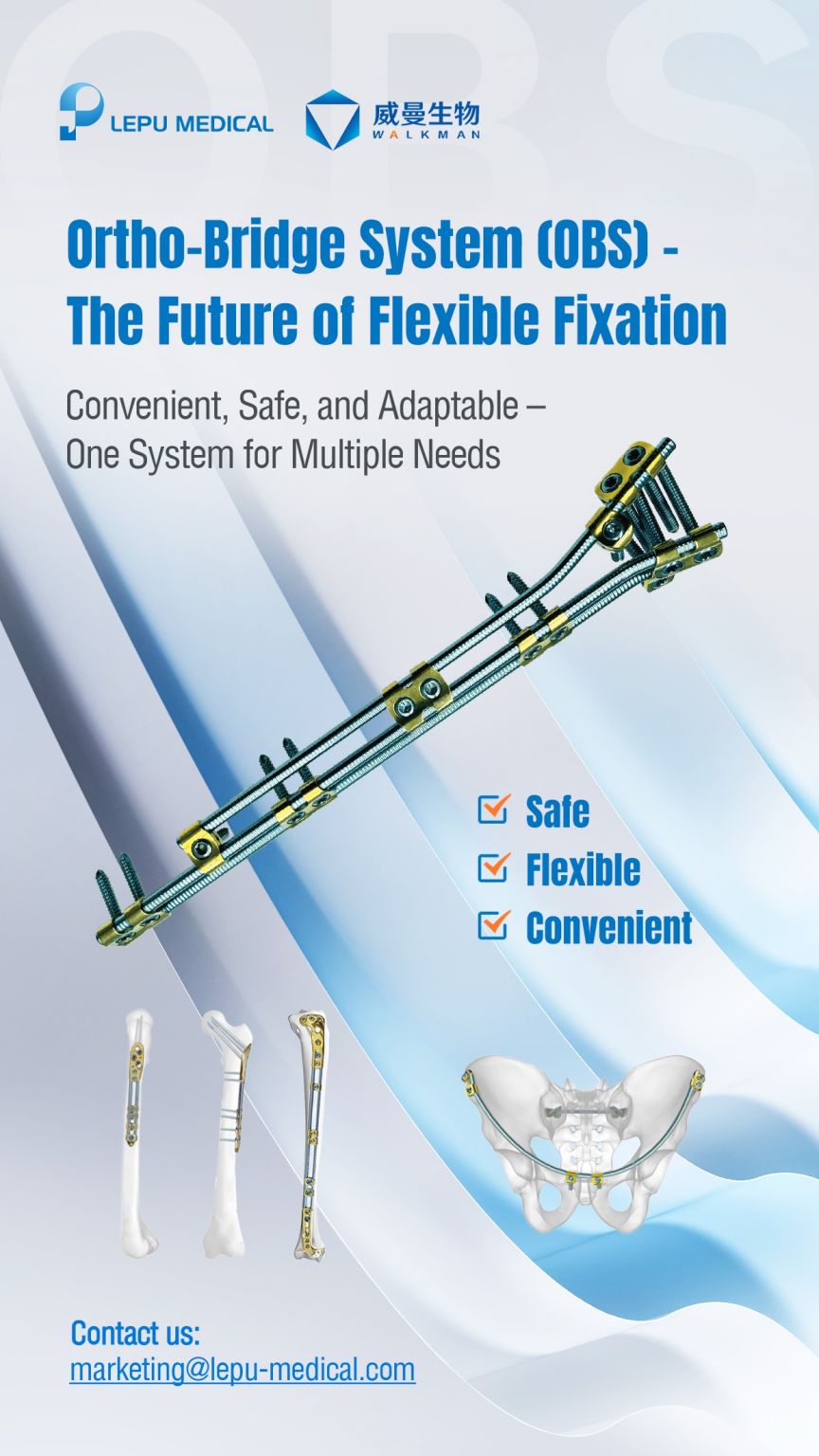 Case Sharing | Middle-to-distal third diaphyseal humerus fracture