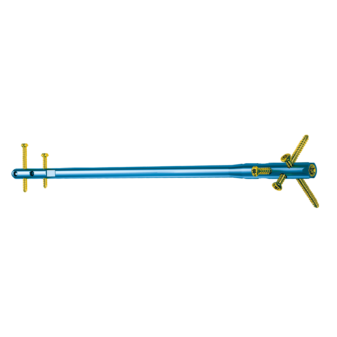 Birbirine intramedüller çivi sistemi