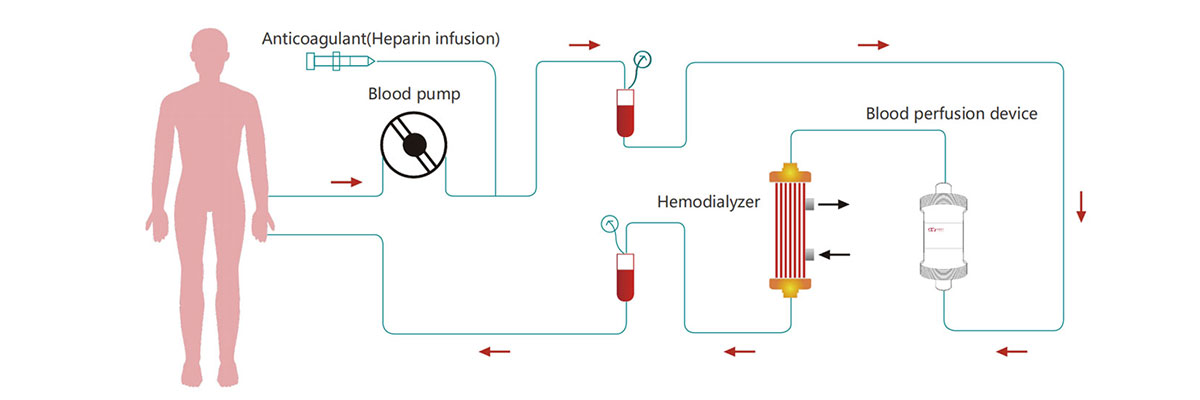How-Disposable-Hemoperfutor-Works.jpg