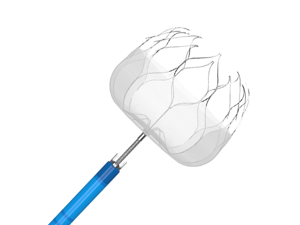 Application and Classification of Left Atrial Appendage Occluder