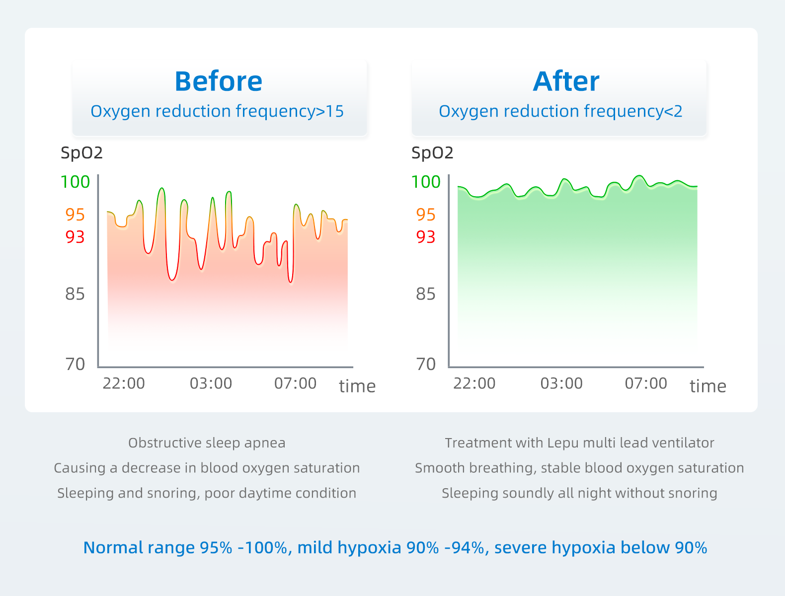 assdesc Daha nce kan oksijen seviyelerinde deiiklikler ve Lepu ventilatr ile tedaviden sonra Ews erk...