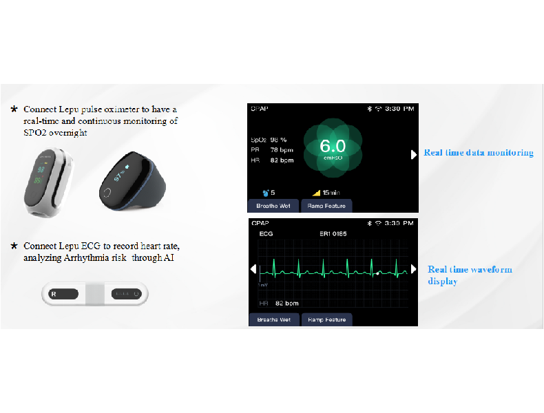 fanyifanyiAvantaj Bluetooth giyilebilir cihazlar destekler, kablo kstlamalarn azaltr Elektrokardiyog...