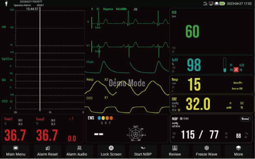 Mini Trend View ECG Ha